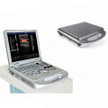 Upgraded Version Laptop Color Doppler Ultrasound Machine